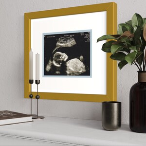 May include: A framed black and white ultrasound image of a baby in a gold frame. The frame is on a white surface with a black candle holder and a black vase with green leaves.