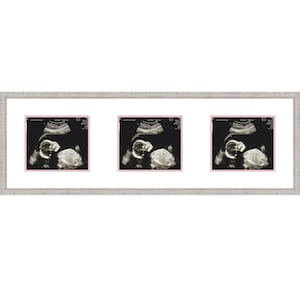 May include: Three black and white ultrasound images of a baby in a silver frame with a pink mat.