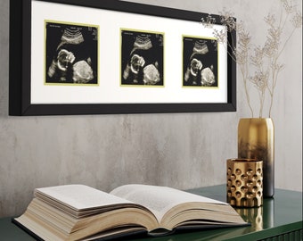 Black Sonogram Frame with Mats to Display 3 Sonograms - with UV Acrylic, Backing & Hanging Hardware | Black Sonogram Frame