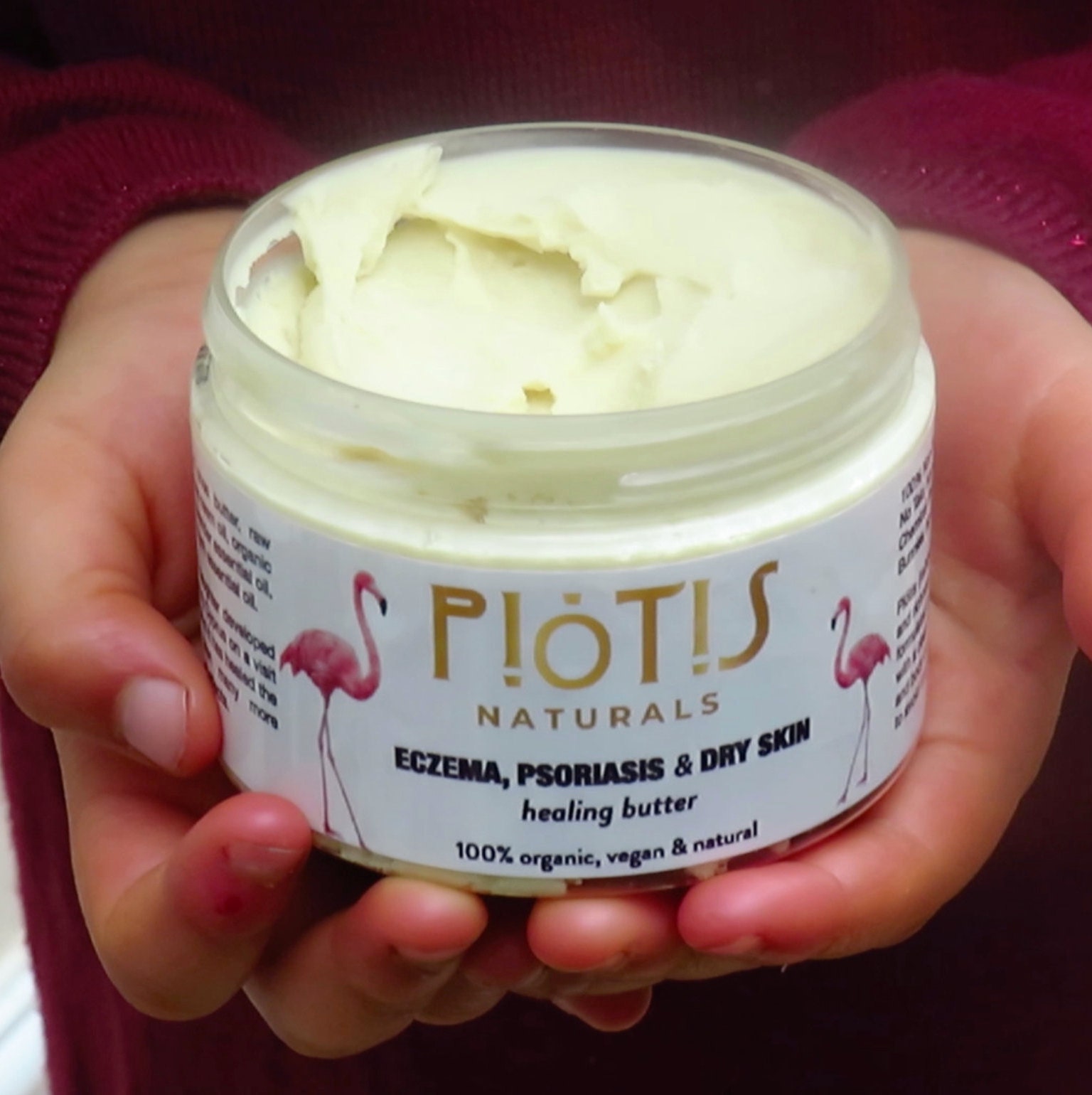 Eczema cream vegan eczema cream organic eczema dry skin Etsy