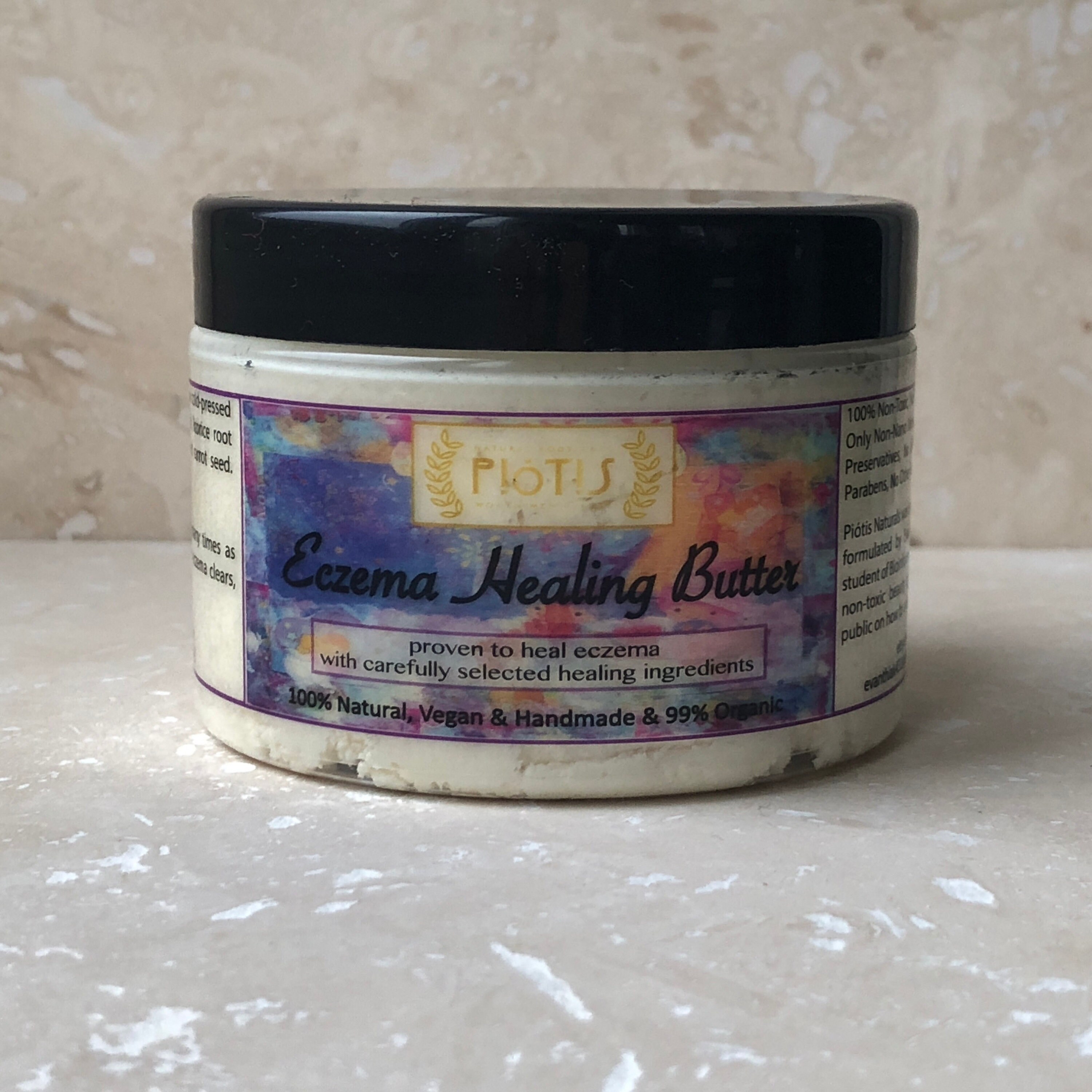 Eczema cream vegan eczema cream organic eczema dry skin Etsy