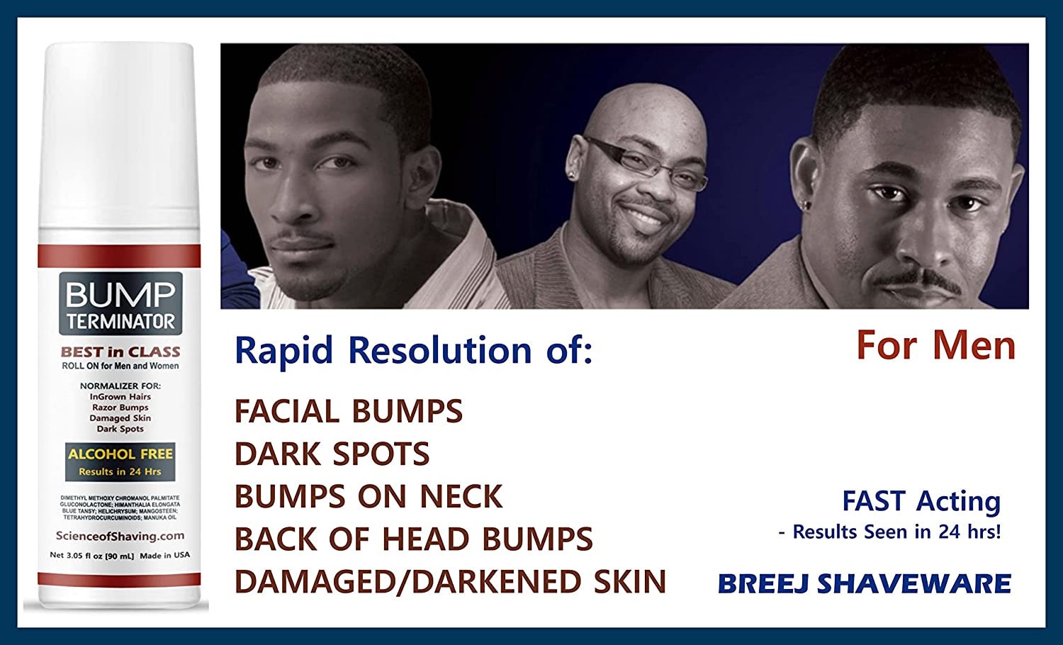 Ingrown Hair On Back Of Head