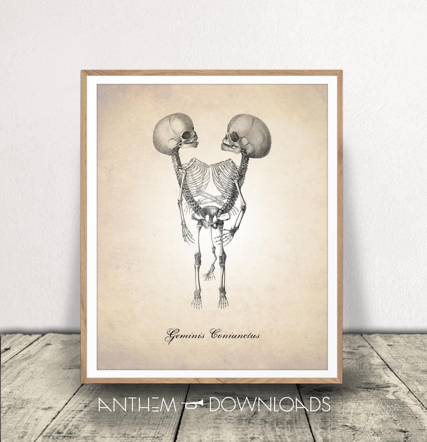Conjoined Twins Art Print Anatomy Drawing Human Anatomy Etsy Norway