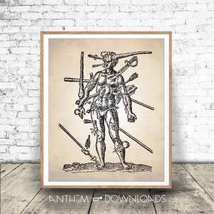 Wounds Man Art Print - Human Anatomy Printable - Anatomy Illustration - Vintage Surgical Diagram - Instant Download