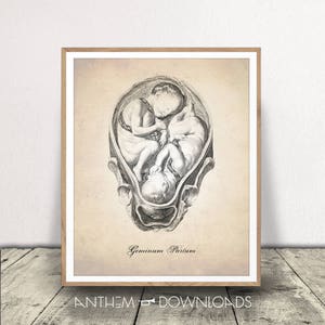 Human Anatomy Descargar Arte - Twin Birth Print - In Utero Anatomy - Twins in Womb - Póster de embarazo - Descarga instantánea!