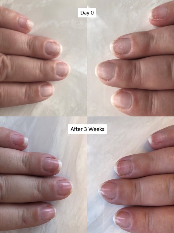 Nail growth after 2+ weeks wearing cheap champagne (LLB+SB+SGT)--almost  ZERO chipping : r/simplynailogical