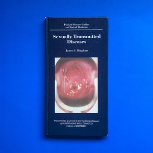 Sexually Transmitted Diseases (Pocket Picture Guides to Clinical Medicine) - Scarce 1985