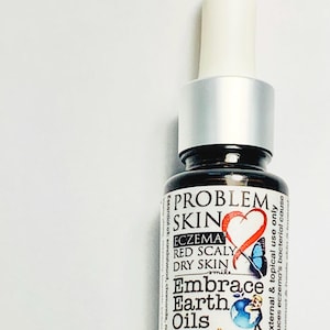 Eczema Relief Oil: Soothes Red, Scaly, Dry Skin