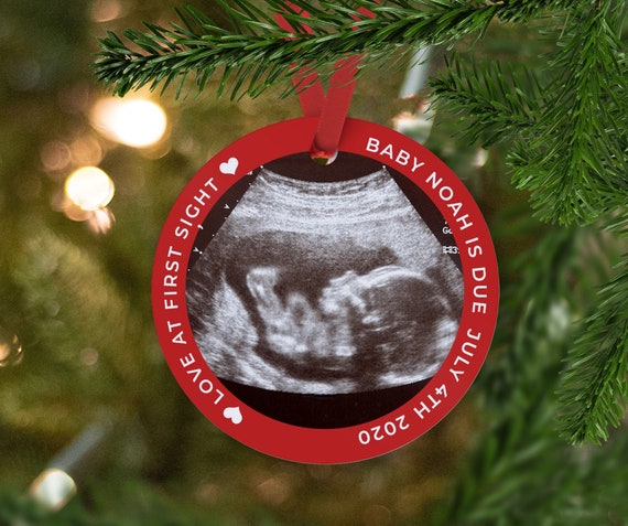 ultrasound ornament