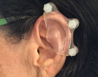 Compression acrylique personnalisée chéloïde - Boucle d'oreille par pression, sur mesure, chéloïde aplatie, gestion des cicatrices, gestion des cicatrices d'oreille