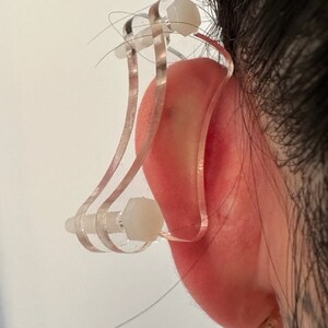 Discos de plástico de compresión para queloides en la oreja: arete de disco de plástico para presión queloide postoperatoria modelo 'Dogbone' imagen 8