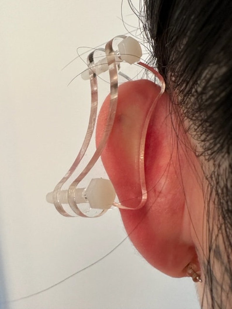 Ear Keloid Compression Plastic Discs Plastic disc earring for post-op keloid pressure model Dogbone image 8