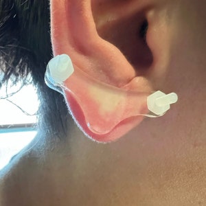 Ear Keloid Compression Plastic Discs Plastic disc earring for post-op keloid treatment model 'bikini' image 3