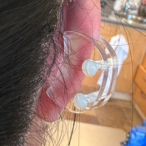 Ear Keloid Compression Plastic Discs Plastic disc earring for post-op keloid pressure'Smiley' shape image 5