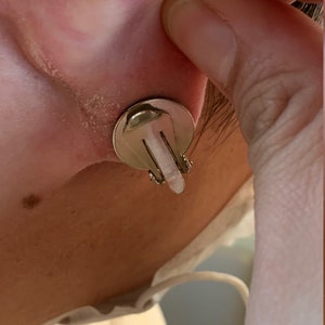 Clip per compressione dei cheloidi dell'orecchio Coppia di orecchini a clip per il trattamento dei cheloidi post-operatori immagine 6