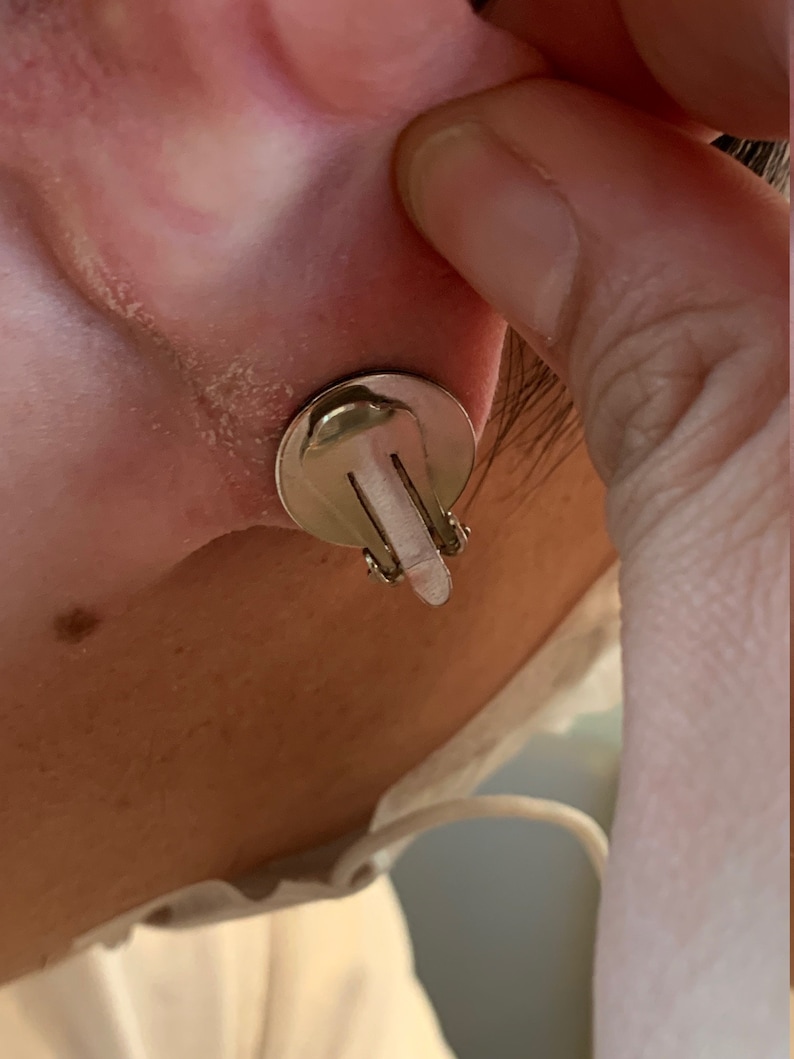 Ohr Keloid-Kompressionsclip Einzelner Ohrclip für die post-opale Keloid-Behandlung Bild 5