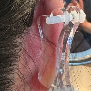 Discos de plástico de compresión para queloides en la oreja: arete de disco de plástico para presión queloide postoperatoria modelo 'Dogbone' imagen 6