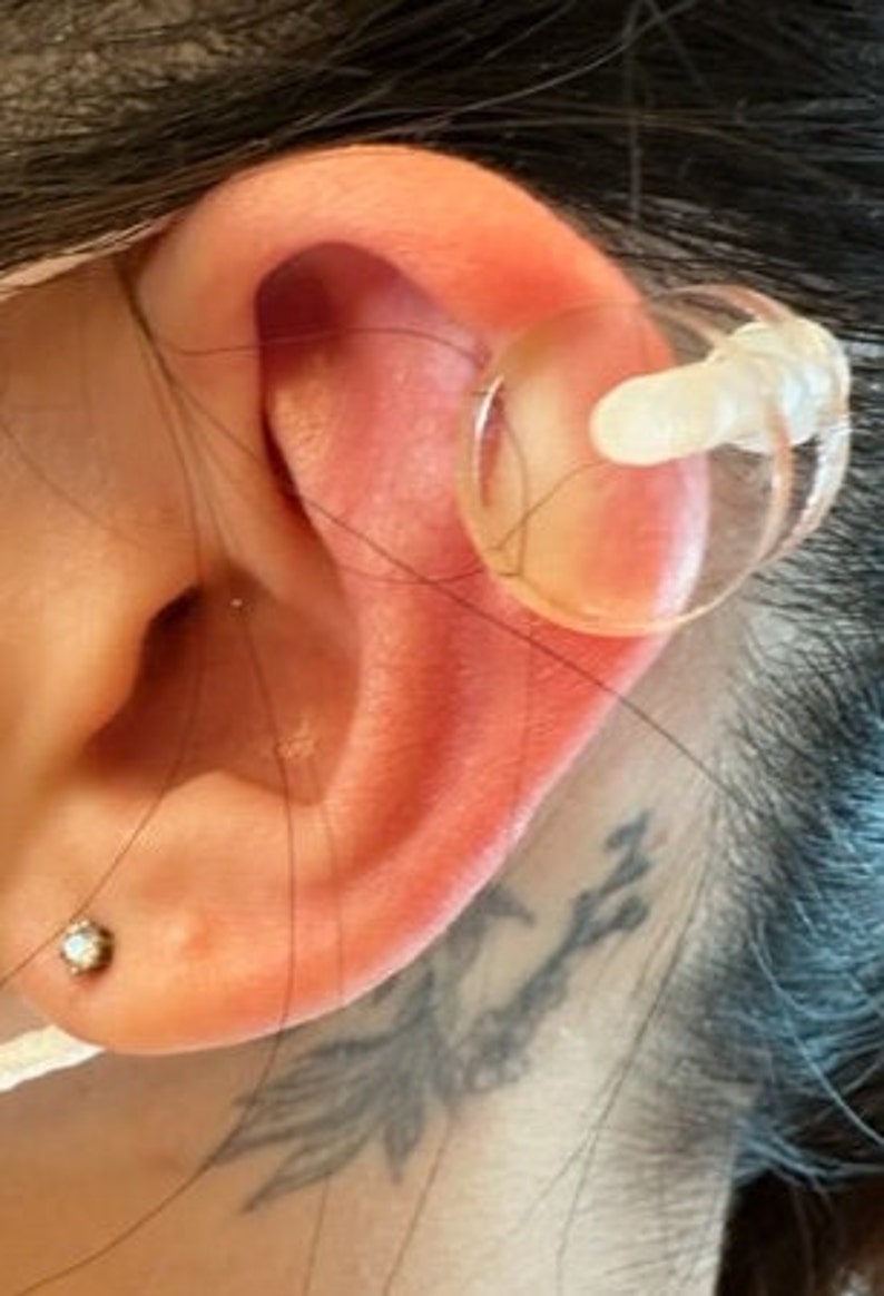 Ohr-Keloid-Kompression Kunststoffscheiben Kunststoff-Ohrring für post-op Keloid-Druck Modell 1,5 cm Bitte siehe Hinweise in der Beschreibung Bild 5