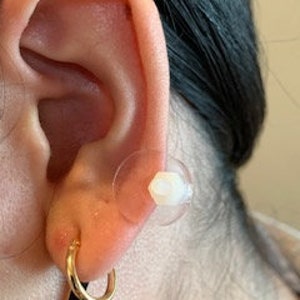 Ohr-Keloid-Kompression Kunststoffscheiben Kunststoff-Ohrring für post-op Keloid-Druck Modell 1,5 cm Bitte siehe Hinweise in der Beschreibung Bild 3