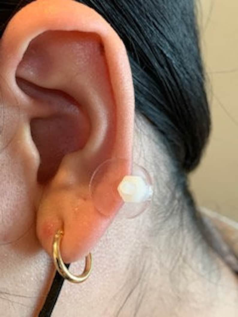 Ohr-Keloid-Kompression Kunststoffscheiben Kunststoff-Ohrring für post-op Keloid-Druck Modell 1,5 cm Bitte siehe Hinweise in der Beschreibung Bild 3