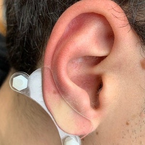 Discos de plástico de compresión para queloides en la oreja: arete de disco de plástico para presión queloide postoperatoria modelo 'Dogbone' imagen 1