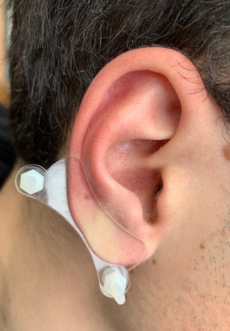 Discos de plástico de compresión para queloides en la oreja: arete de disco de plástico para presión queloide postoperatoria modelo 'Dogbone' imagen 1