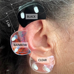 Ear Keloid Compression Plastic Discs Plastic disc earring for post-op keloid pressure'Smiley' shape image 1