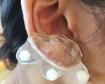 Ear Keloid Custom Acrylic Compression Pressure Earring, Made to Fit,  Flatten Keloid, Scar Management, Ear Scar Management 