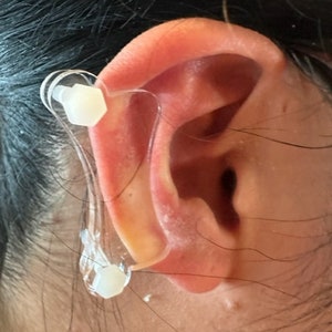 Discos de plástico de compresión para queloides en la oreja: arete de disco de plástico para presión queloide postoperatoria modelo 'Dogbone' imagen 5
