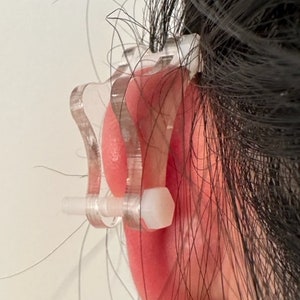 Ear Keloid Compression Plastic Discs Plastic disc earring for post-op keloid treatment model 'bikini' image 5