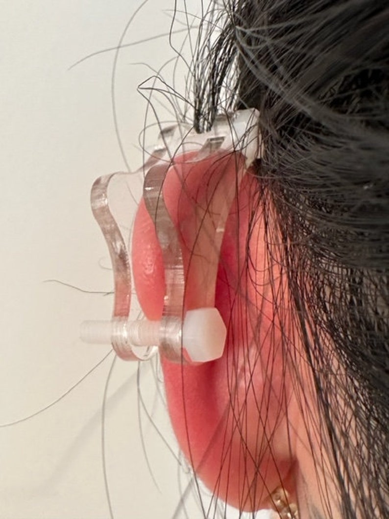 Ear Keloid Compression Plastic Discs Plastic disc earring for post-op keloid treatment model 'bikini' image 5