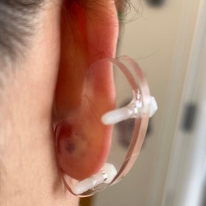 Ear Keloid Compression Plastic Discs Plastic disc earring for post-op keloid pressure 'Bean' shape 3 sizes available image 7