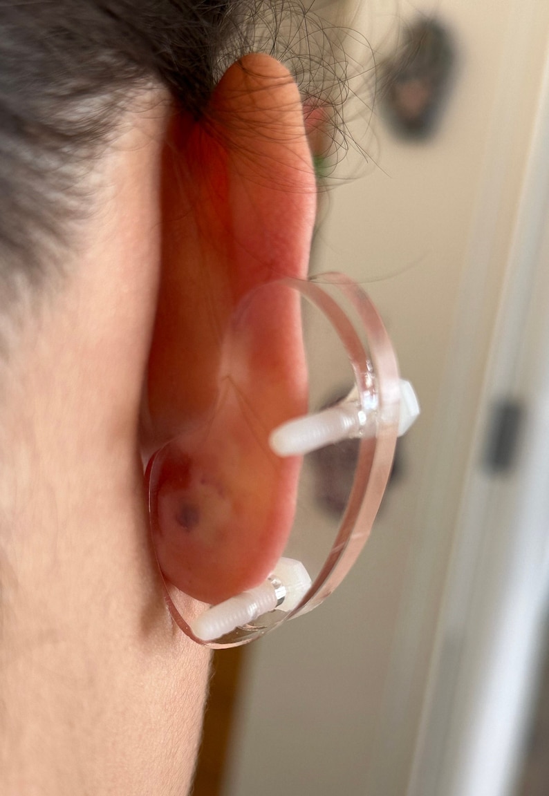 Ear Keloid Compression Plastic Discs Plastic disc earring for post-op keloid pressure 'Bean' shape 3 sizes available image 7