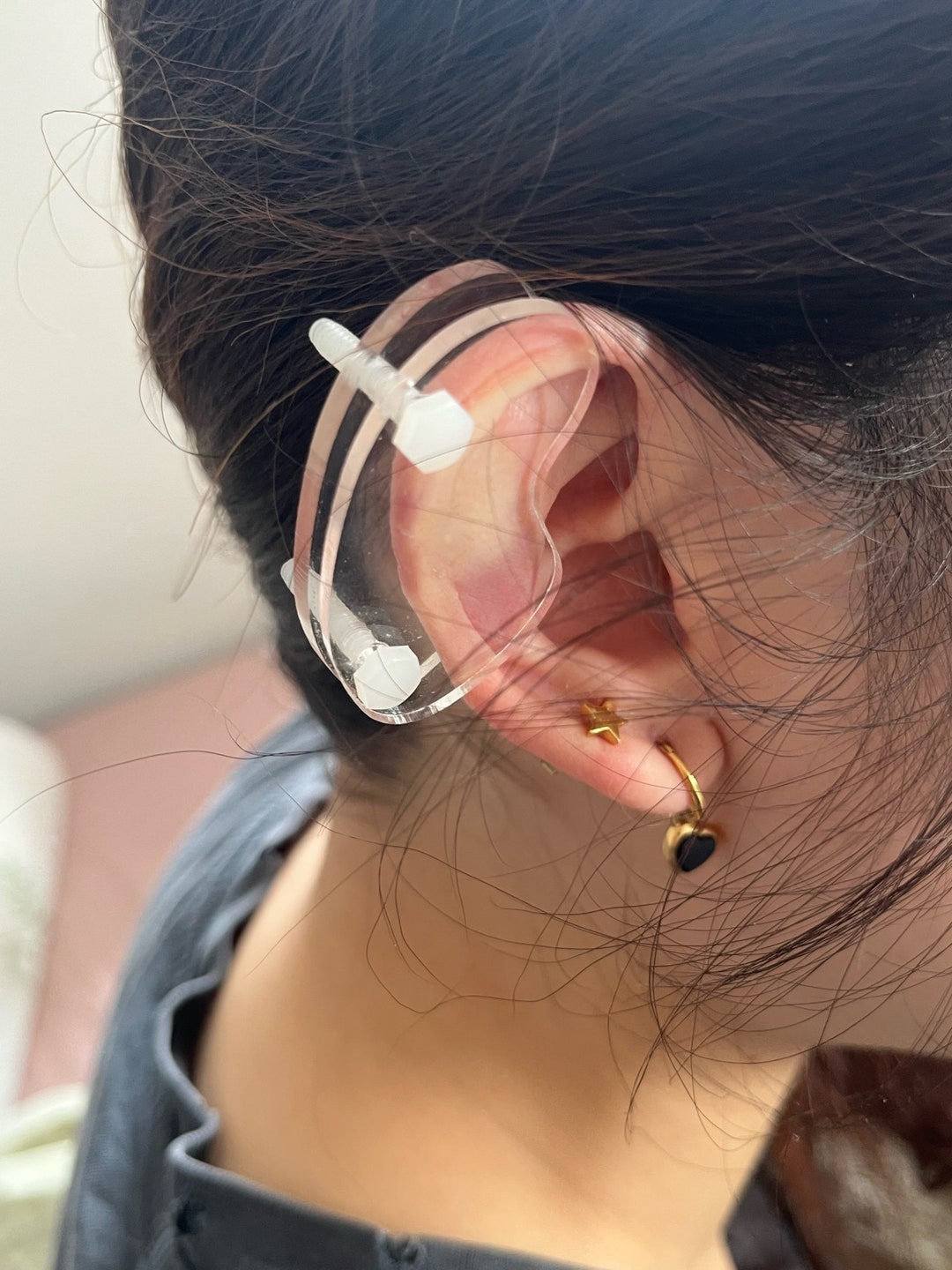 Scar Tissue Silicone Earrings For Keloids Keloid Scars Zimmer