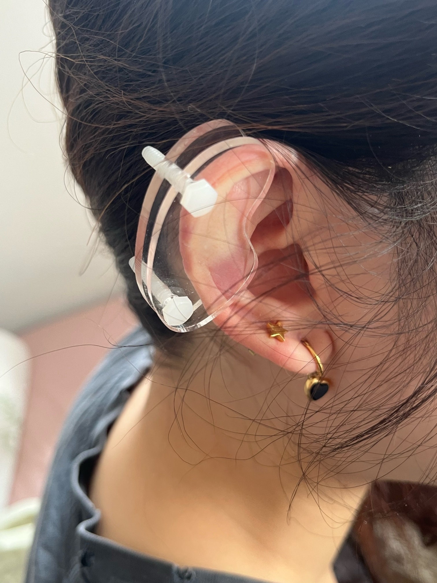 Ear Keloid Compression Plastic Discs Plastic Disc Earring for Post