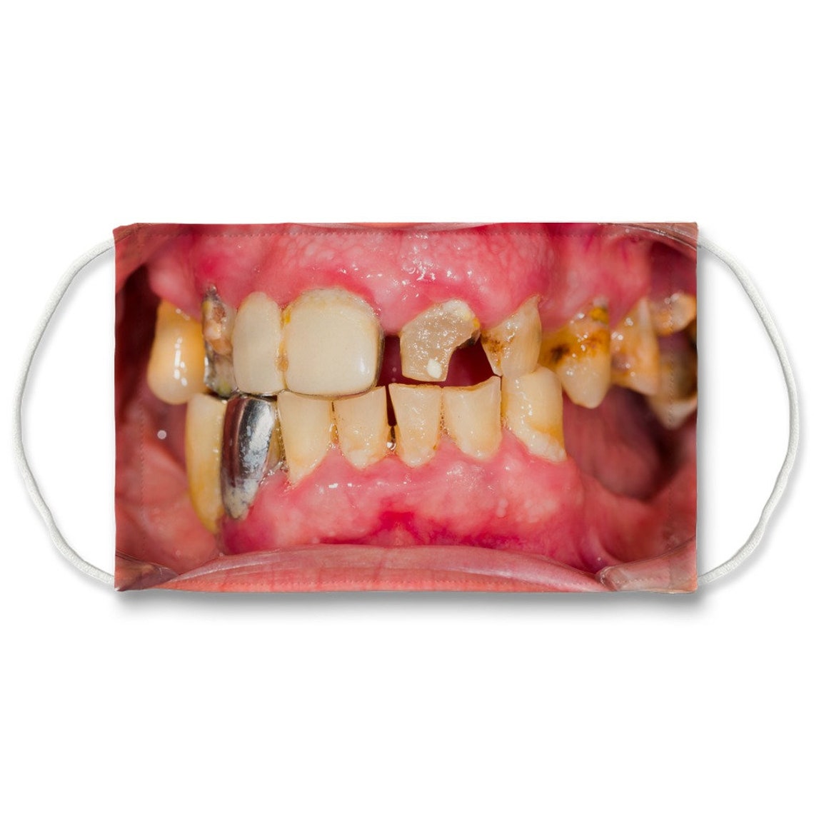 Tooth Decay Mask Comes With 5 Nose Crimps and Mouth and Nose Etsy