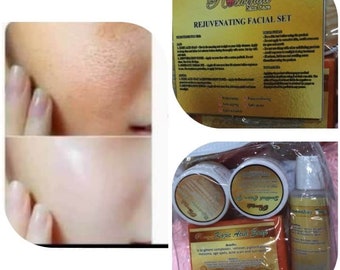 roswinda melasma soap