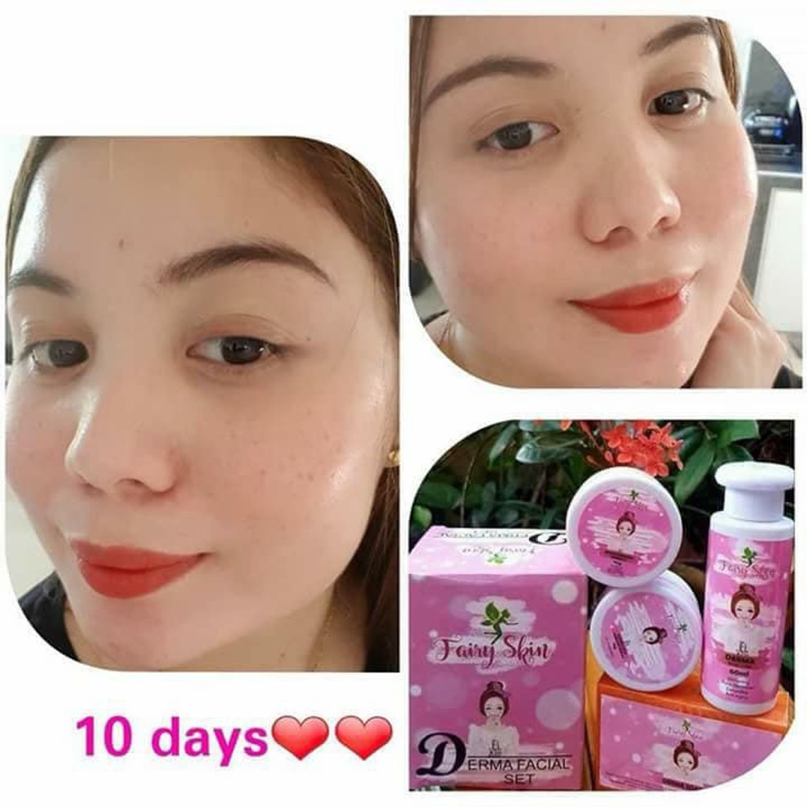 Fairy Skin Derma Facial Set Whitening Glowing Koren Skin Etsy