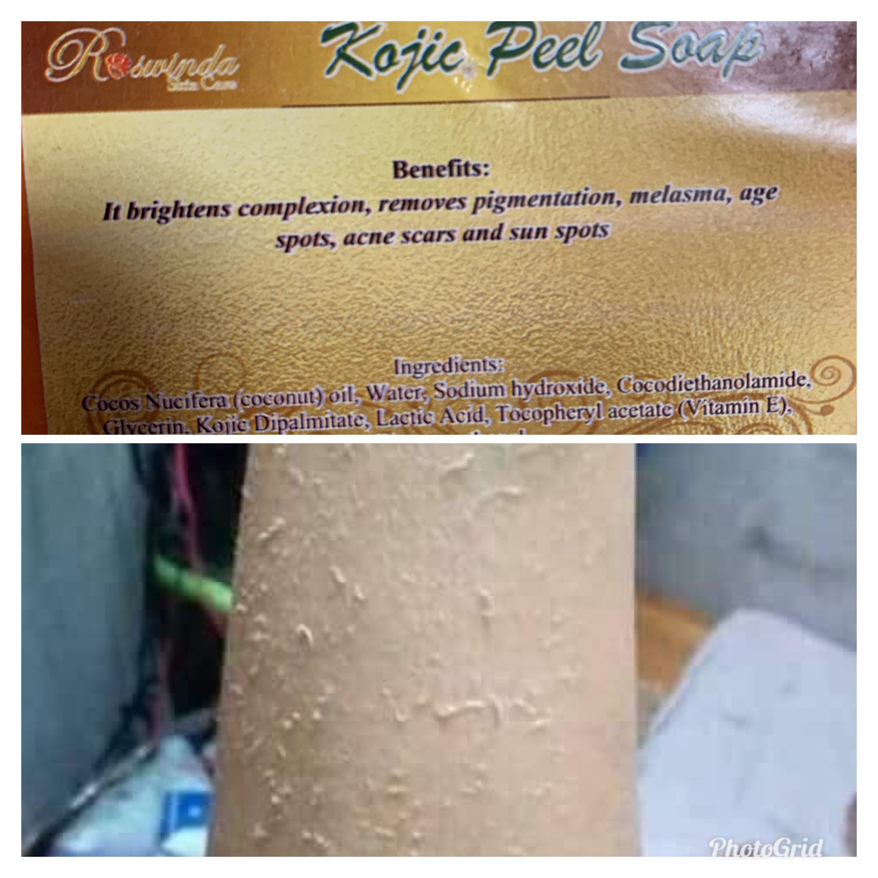 Kojic Peeling Soap Brightening Micro Peeling Etsy