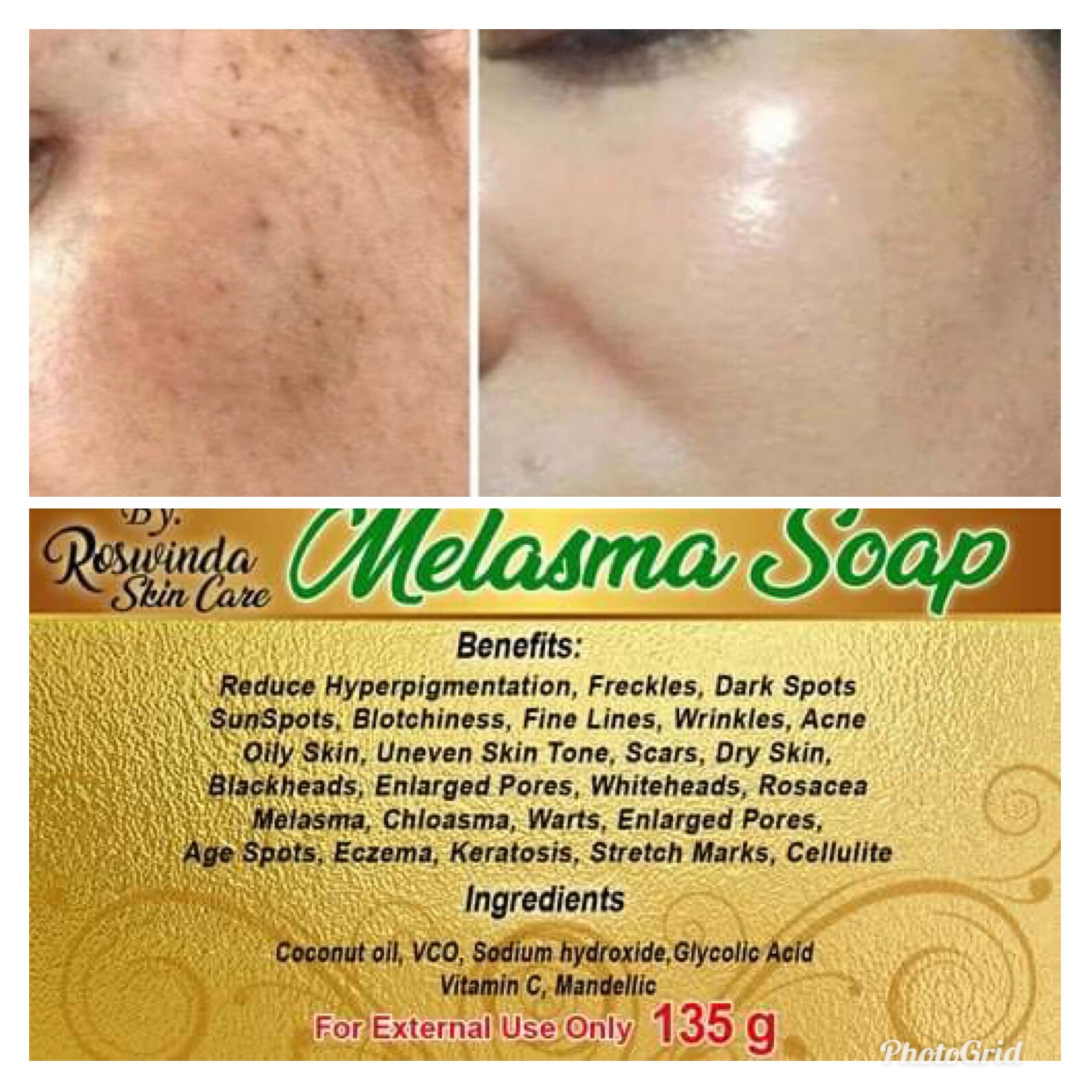 Best Seller Roswinda Skin Care Whitening Soap Lightening