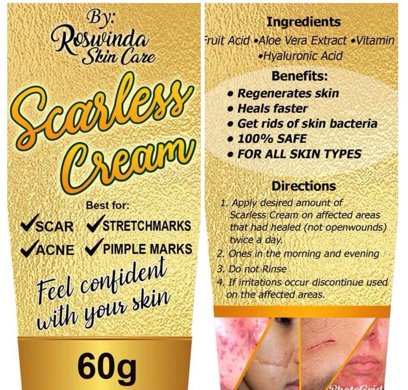 2 in 1 Kasoy Cream Removes Warts Moles Skin Tag & More Etsy