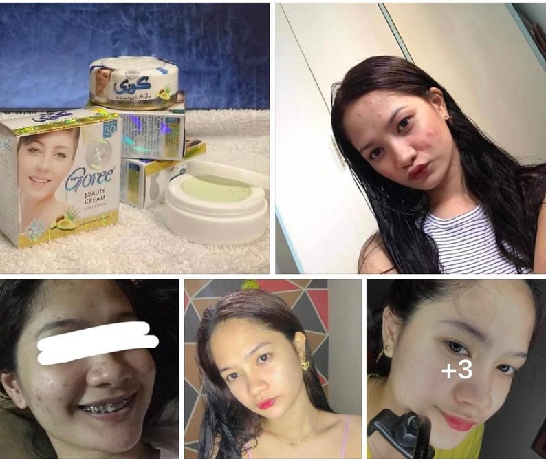 Goree Beauty Cream With Lycopene Avocado & Aloevera Whitening Etsy