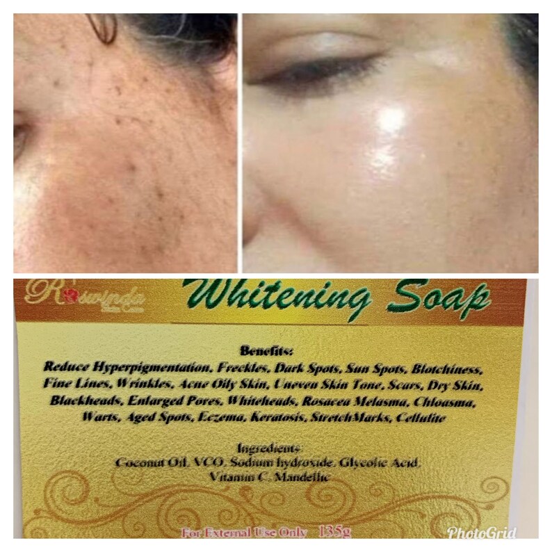 Dermatologist recommended skin whitening soap