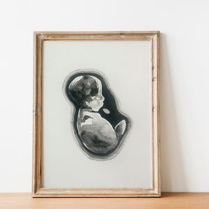 Custom Ultrasound/Sonogram Hand-Painted Watercolor Painting Nursery Decor & New Baby gifts