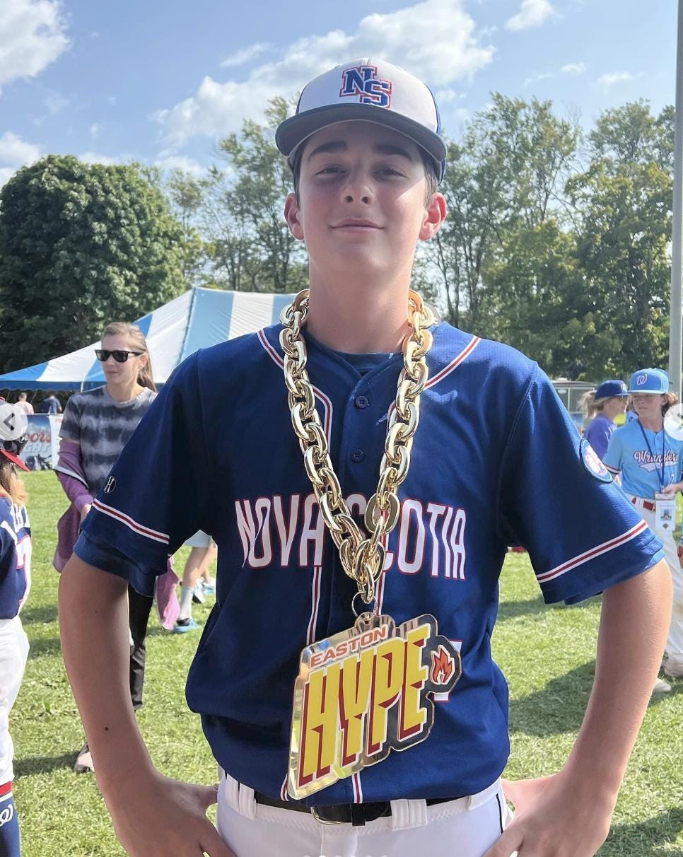 Custom Uv Printed Oversized Sports Chains / Gold Oversized Chain ...
