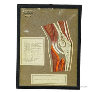 Antique Scientific Visual Aid - Bone Cut of the Human Elbow