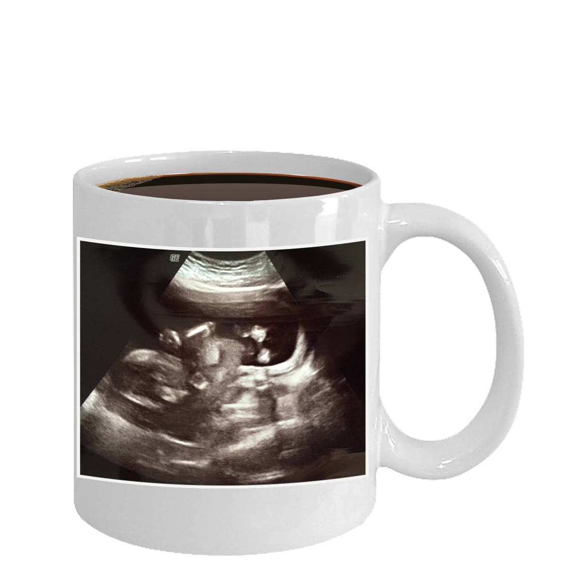 Custom Personalized Ultrasound Sonogram Baby Coffee Mugbaby