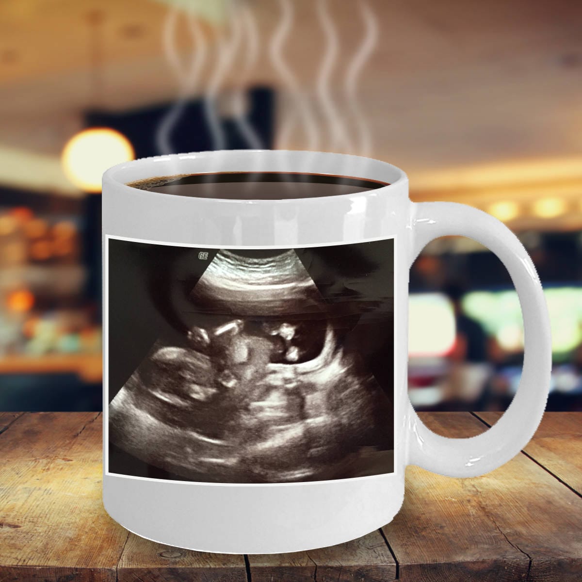 Custom Personalized Ultrasound Sonogram Baby Coffee Mugbaby Announcement,gender Reveal