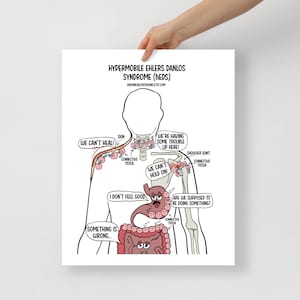 Funny hypermobile ehlers danlos syndrome (hEDS) cartoon Poster