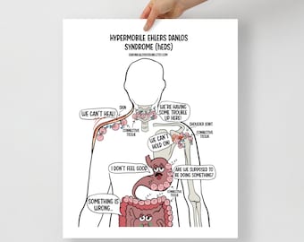 Puede incluir: Una ilustración en blanco y negro de una persona con varias partes del cuerpo resaltadas. La ilustración muestra los síntomas del síndrome de Ehlers-Danlos hipermóvil (HEDS). El texto de la imagen dice: "Síndrome de Ehlers-Danlos hipermóvil (HEDS)", "Chronicallydoodling.etsy.com", "¡No podemos sanar!", "¡Estamos teniendo problemas aquí arriba!", "¡No podemos aguantar!", "No me siento bien", "Algo anda mal...", "¿Se supone que debemos hacer algo?", "Piel", "Tejido conectivo", "Articulación del hombro", "Tejido conectivo", "Tejido conectivo".